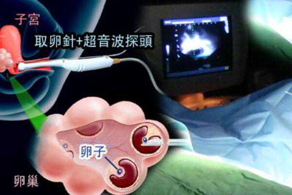 2023武汉供卵试管多少钱 武汉同济医院试管婴儿成功率影响成功率的因素有哪些